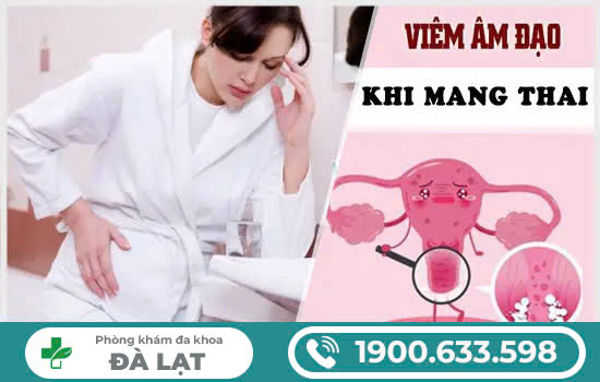 Hình ảnh minh họa